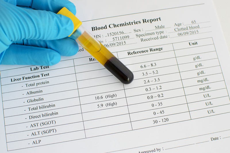 Các xét nghiệmchức năng gan giúp xác định sức khỏe của gan bằng cách đo nồng độ protein, men gan và bilirubin trong máu. 